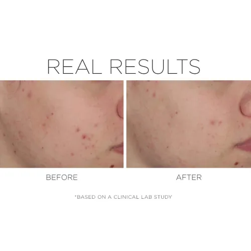 Cosmedix Shineless Oil Free Moisturiser